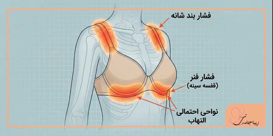 آیا استفاده از سوتین فنردار ضرر دارد؟